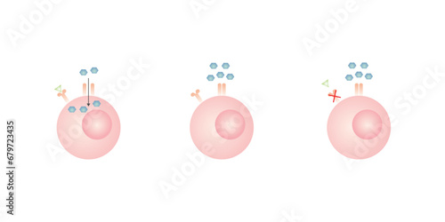 Diabetes Mellitus (Type 1 and Type 2 Diabetes) Scientific Design. Vector Illustration.