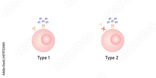 Diabetes Mellitus (Type 1 and Type 2 Diabetes) Scientific Design. Vector Illustration.