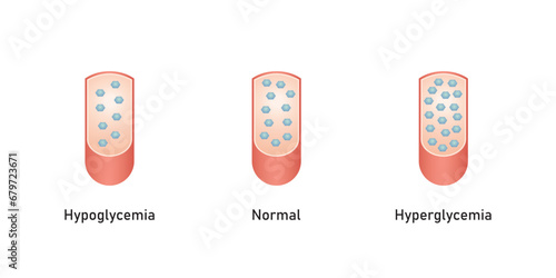 Blood glucose Level Scientific Design. Vector Illustration.
