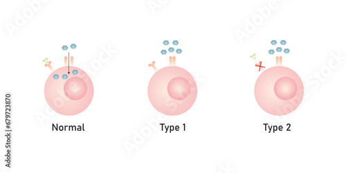 Diabetes Mellitus (Type 1 and Type 2 Diabetes) Scientific Design. Vector Illustration.