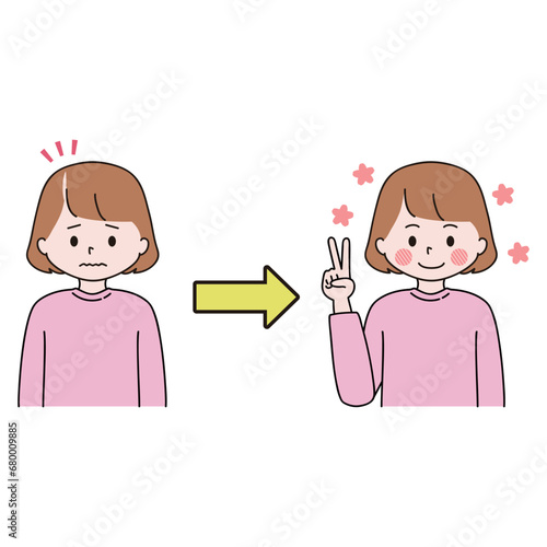 FAGA　分け目の薄毛の治療に成功した女性　ピース