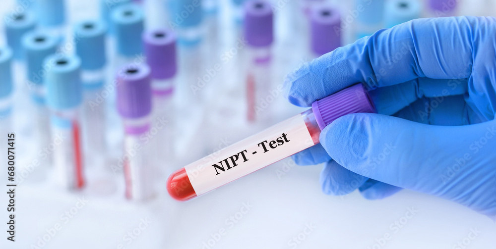 Doctor holding a test blood sample tube with NIPT test on the background of medical test tubes with analyzes Doctor holding a test blood sample tube with NIPT test on the background of medical test tubes with analyzes