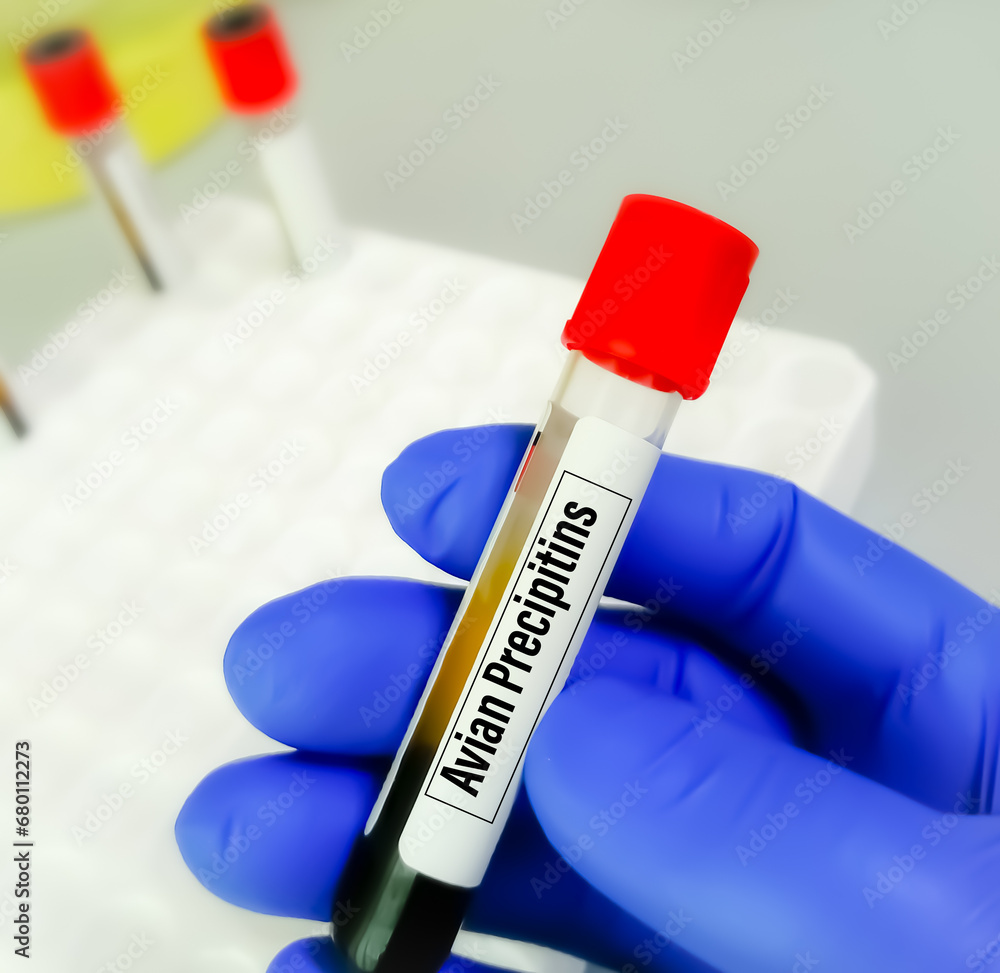 Fototapeta premium Blood sample for Avian Precipitins test
