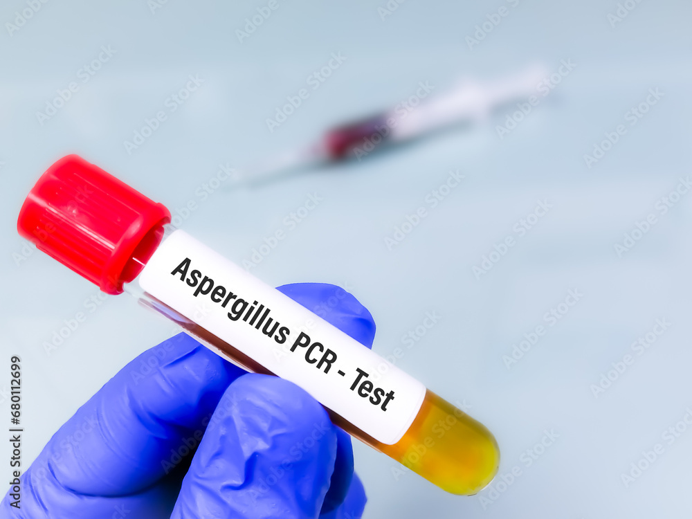 Obraz premium Scientist holding sample for Aspergillus PCR testing