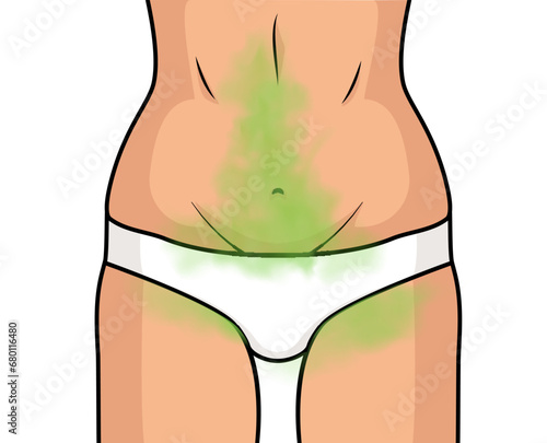 Woman vagina odor smell banner background. Medical care woman disease symbol stink