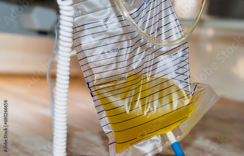 Urine bag with full of pee and pee catheter hang under patient bed.  photo