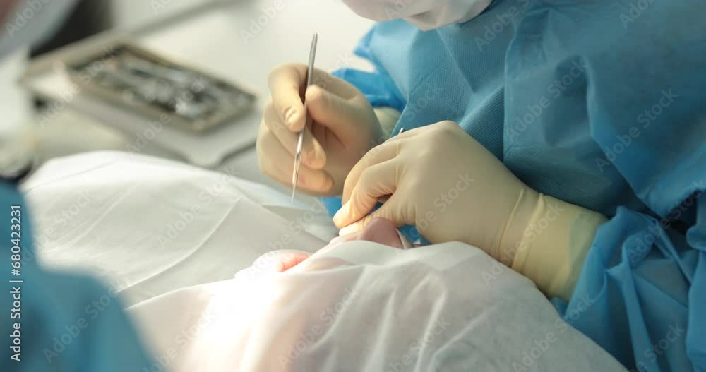 Dental treatment close-up. A dentist performs a dental procedure. Dentist's hands at work. Oral cavity in the process of treatment at the dentist. Dental treatment close-up. A dentist performs a dental procedure. Dentist's hands at work. Oral cavity in the process of treatment at the dentist.