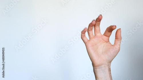 Close-up of the hand of a girl with vitiligo doing a finger snap on a white background. The skin disease vitiligo is a dermatologic disease. photo