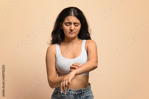 Skin Disorders. Young indian woman suffering eczema, scratching irritated skin on arm photo