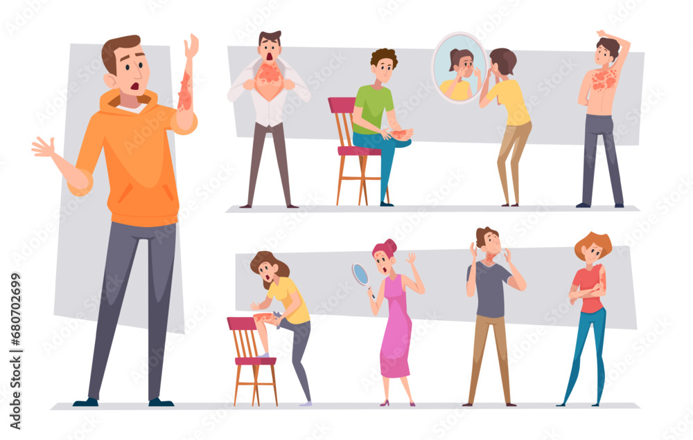 Damaged skin. Cartoon people with problem skin exact vector medical concept illustrations in cartoon style Damaged skin. Cartoon people with problem skin exact vector medical concept illustrations in cartoon style