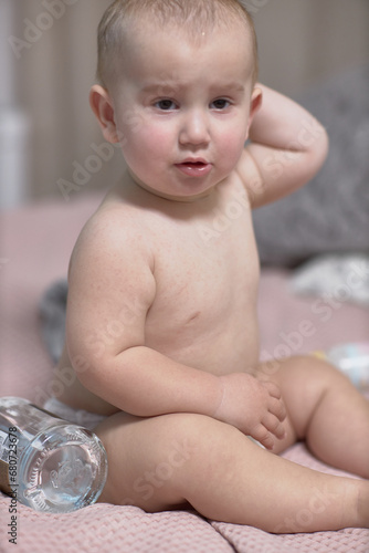 Roseola is the beginning of the course of the disease in the baby, there are barely noticeable spots on the skin rash photo