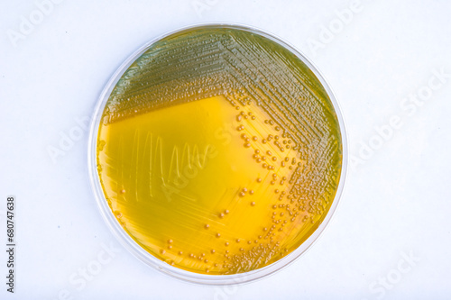 Photos Vibrio cholerae colonies growing in a petri dish with Thiosulfate Citrate Bile S