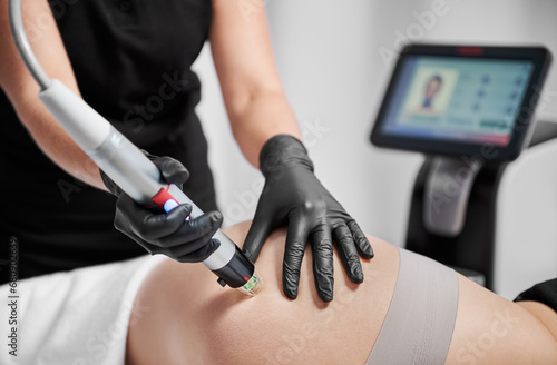 Fotografija Close up of cosmetologist using radiofrequency microneedling device while removing stretch marks on female skin