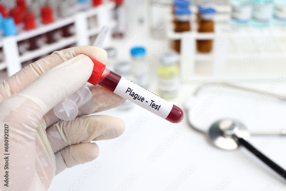 Plague test to look for abnormalities from blood Plague test to look for abnormalities from blood
