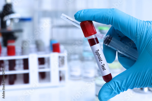 Typhoid test to look for abnormalities from blood photo