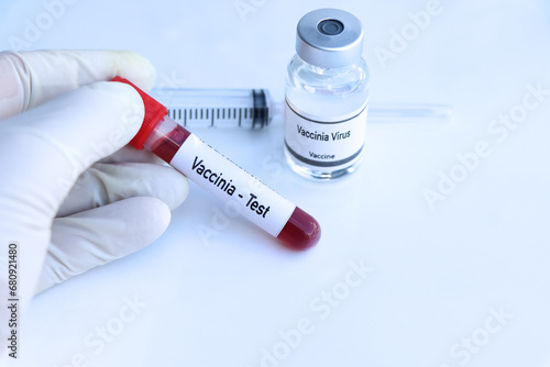 Vaccinia test to look for abnormalities from blood photo