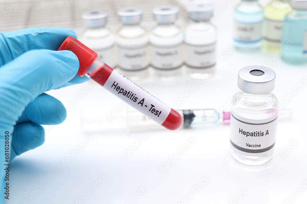 Hepatitis A test to look for abnormalities from blood Hepatitis A test to look for abnormalities from blood
