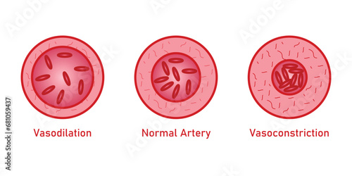 Vasodilation and vasoconstriction. Normal cross section. Normal blood vessel. Scientific resources for teachers and students.
