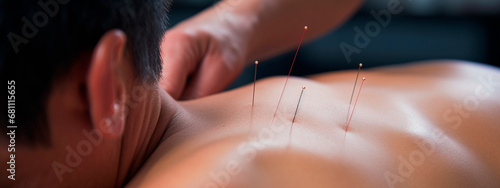 Acupuncture back neck spa salon. Generative AI,