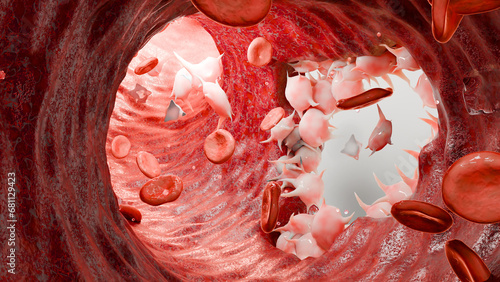 Tableau sur toile Hemostasis
