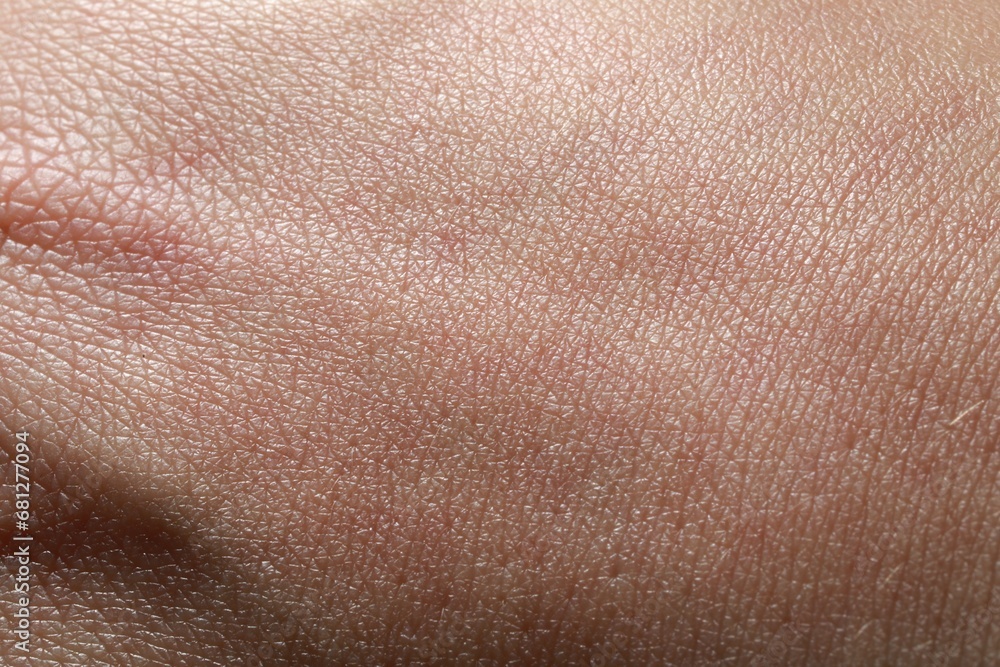 Fototapeta premium Closeup view of dry human skin as background