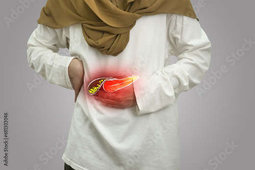 Digital composition of human gallbladder stone with highlighted red inflammation on sick person, woman with stomach pain, health and medical photo