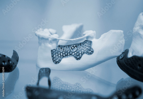 Facial bone of lower human jaw individual prosthesis printed on 3D printer from metal powder. Medical titanium prototype of jaw bone created by powder 3D printer. Implantation of endoprosthesis photo