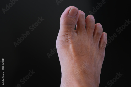 Close up shot of a man's right foot over dark background photo