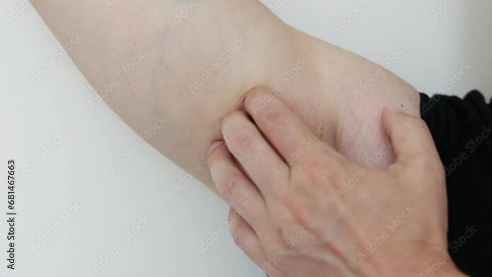 Armpit allergy. Young man shows and scratches irritation by hand on