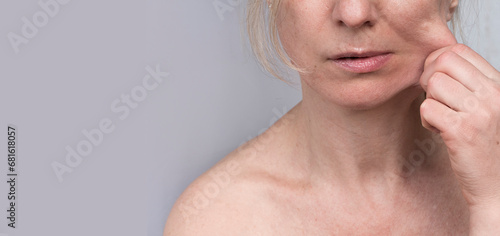 Foto Facelift training