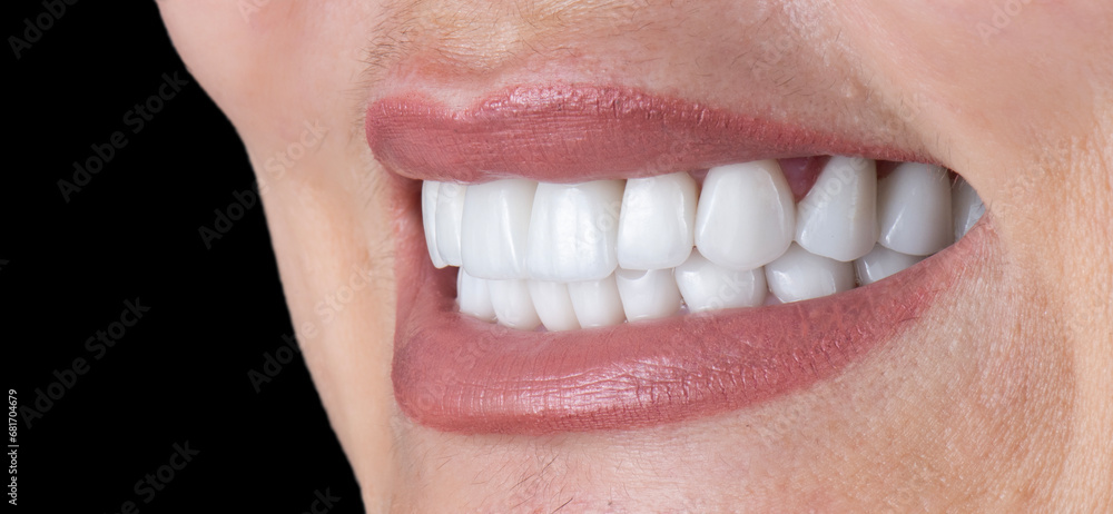 Obraz premium dental treatment pictures