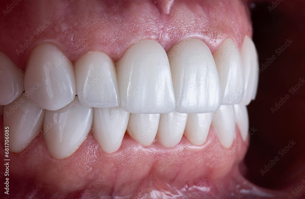 dental treatment pictures