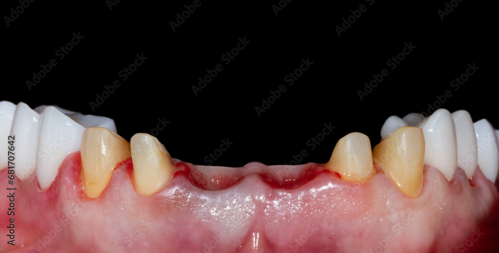 dental treatment pictures