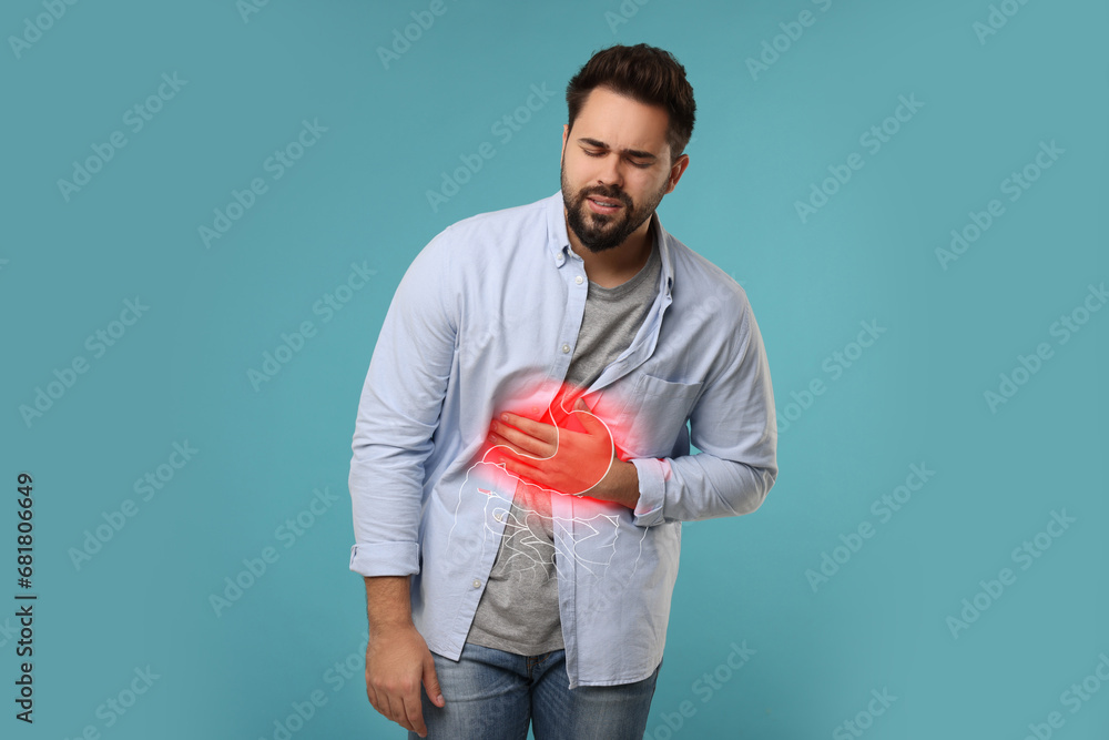 Man suffering from stomach ache on light blue background. Illustration of unhealthy gastrointestinal tract Man suffering from stomach ache on light blue background. Illustration of unhealthy gastrointestinal tract