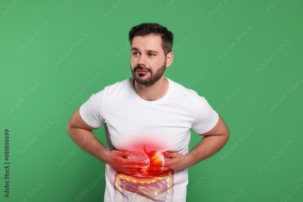 Man suffering from stomach ache on green background. Illustration of unhealthy gastrointestinal tract Man suffering from stomach ache on green background. Illustration of unhealthy gastrointestinal tract