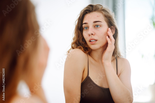 Close-up of a young woman with problem skin looking in the mirror, touching her cheek with acne. Cosmetic care. Dermatology.