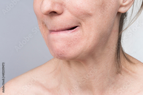 A woman does facial exercises to rejuvenate her facial skin. Healthy aging concept without Botox and plastic surgery.