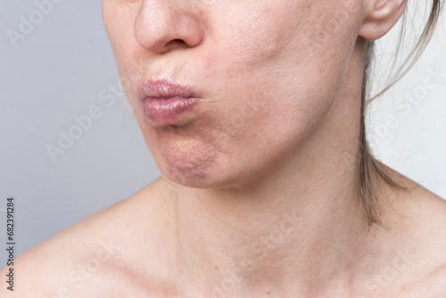 Nice woman training her facial muscles. Self-massage, yoga massage, lip exercises. face, self-massage and facial oval lifting.