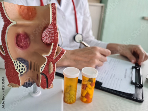 Female doctor holds pills and model of rectum in hand