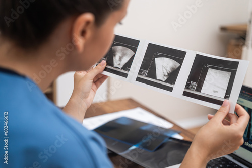 IVF Ultrasound Examination: close up doctor scrutinizes ultrasound results, recording detailed notes on her laptop 