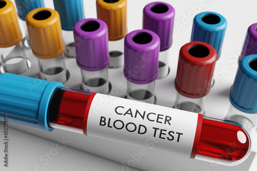 Test tube labelled with CANCER BLOOD TEST in front of a rack of colorful test tubes on white background. Illustration of the concept of cancer research photo