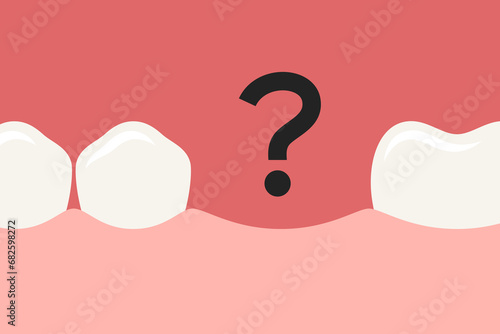 Row of teeth with one tooth missing and question mark