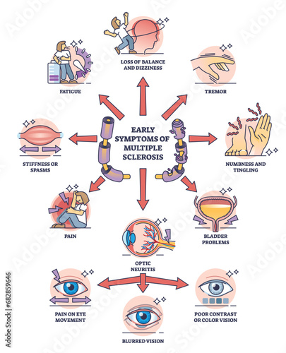 Early symptoms of multiple sclerosis and MS affected things outline diagram. Labeled educational medical scheme with potential problems after diagnosed illness or body condition vector illustration.