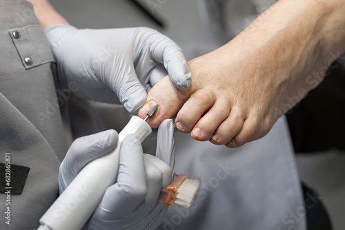 The process of filing off a thickened old nail from the fingers of an elderly woman. Procedure podologist.