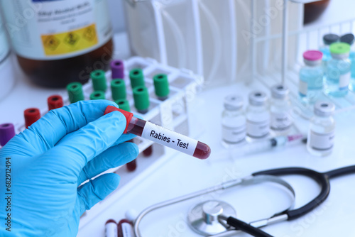 Rabies test to look for abnormalities from blood
