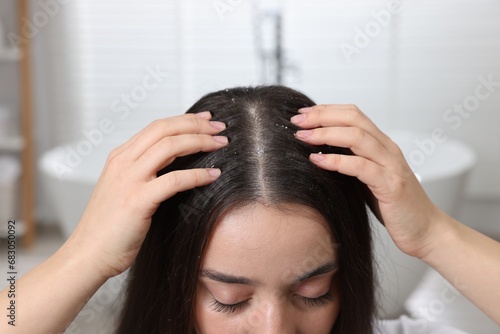 Woman examining her hair and scalp at home, closeup. Dandruff problem photo