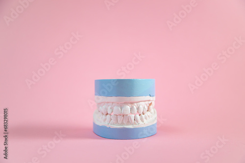 Plaster model of teeth on a pink background. photo
