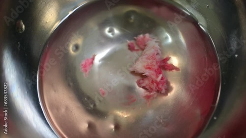  Herniated lumbar discs in a surgical bowl of water after herniated disc surgery. photo