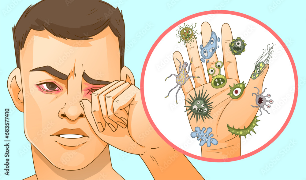 Inflammation of the eyes. Eye irritation. Allergy. Conjunctivitis, stye