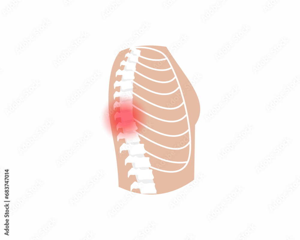Pain in spin joint Arthritis back joint pain syndrome spin Skeleton Bones Pain Injury and Inflammation vector illustration.
Pain in spin joint Arthritis back joint pain syndrome spin Skeleton Bones Pain Injury and Inflammation vector illustration.